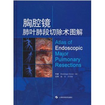 胸腔镜肺叶肺段切除术图解_(法)戈索