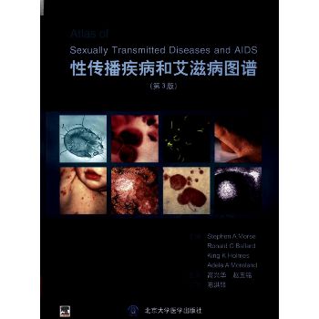 性传播疾病和艾滋病图谱（第三版）
