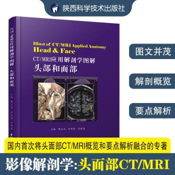 CT MRI应用解剖学图解 头部和面部_韩玉成，孙传恕，沈晓速主编2020