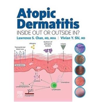 特应性皮炎：由内而外或由外而内.电子版Atopic Dermatitis：Inside Out or Outside in_Lawrence S. Chan2023P317_9780323847445