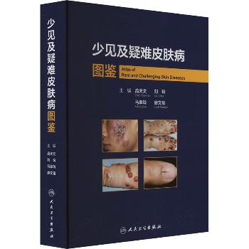 少见及疑难皮肤病图鉴_高天文2024P2687_9787117357272电子版