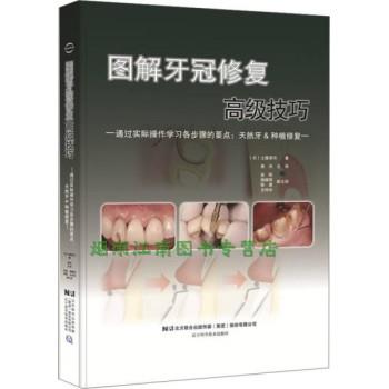 图解牙冠修复高级技巧（日）土屋贤司2017P145_14253974