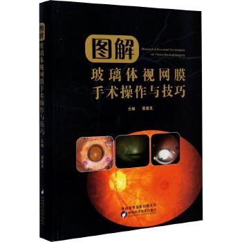 图解玻璃体视网膜手术操作与技巧_雷春灵主编_2020